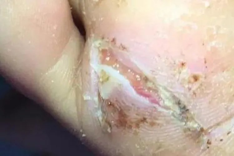 右脚足底疼痛位置图