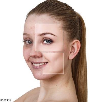 中医如何祛斑 揭秘中医美容祛斑法