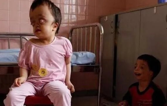 福岛核泄漏后变异女人是真的吗 乍一看十分骇人