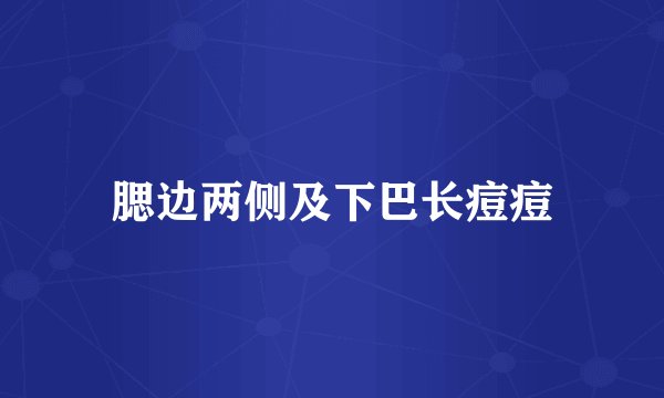 腮边两侧及下巴长痘痘