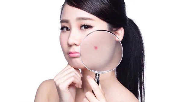 怎么样去除痘坑