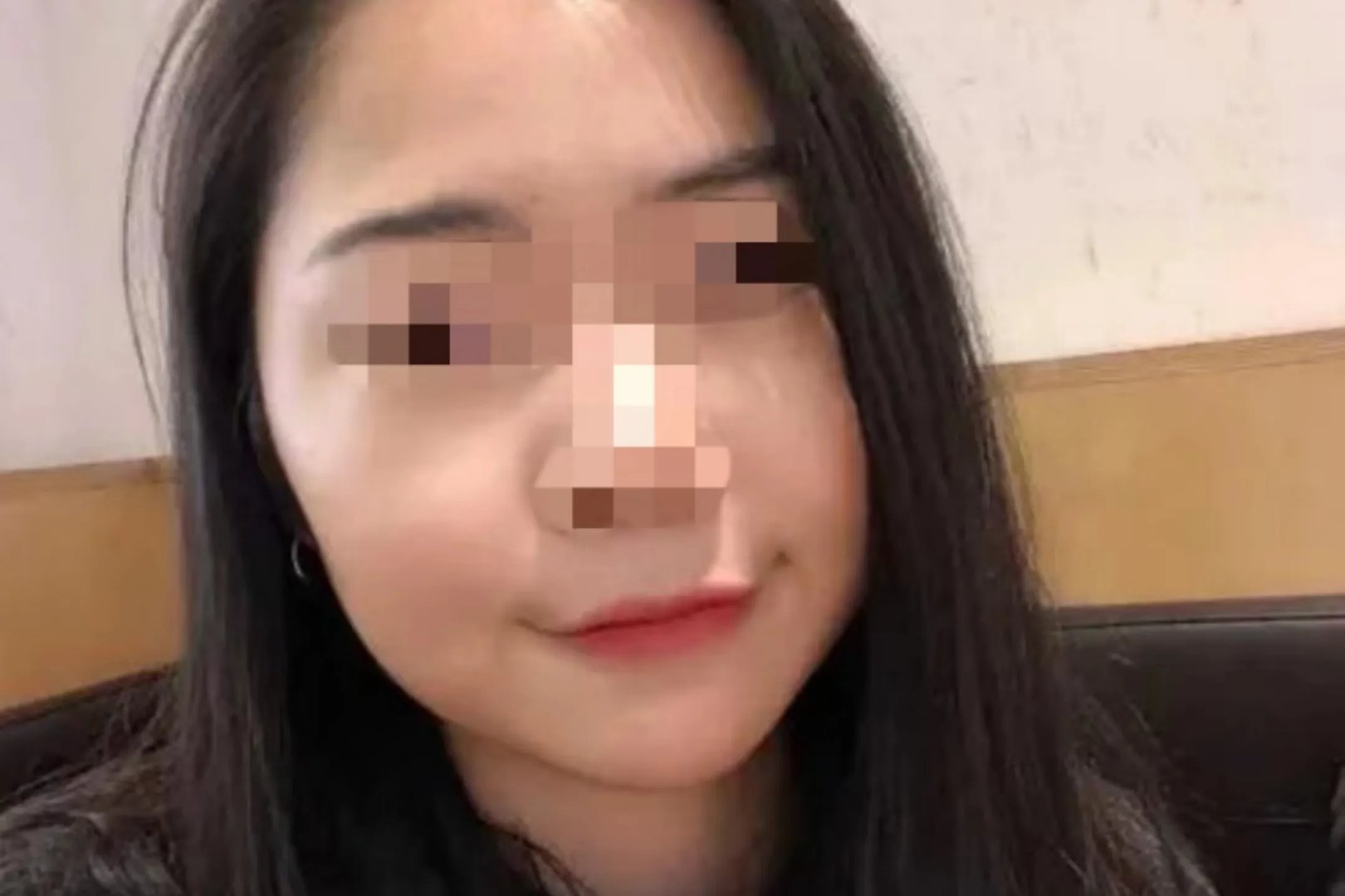 胖脸和满月脸的区别图片