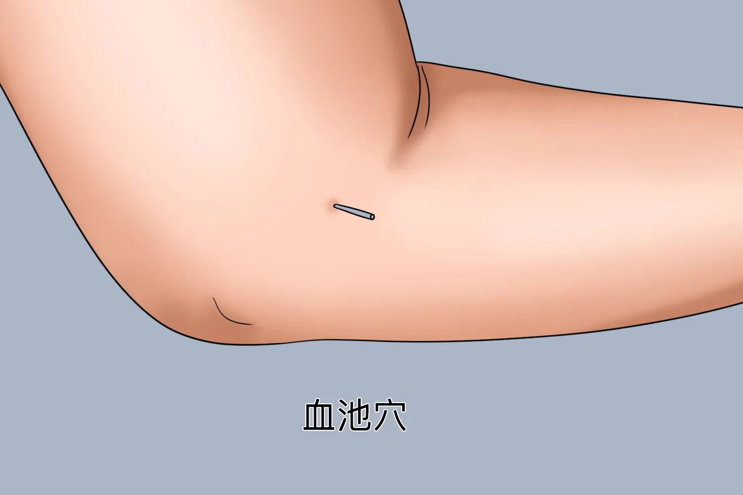 手臂针灸图片