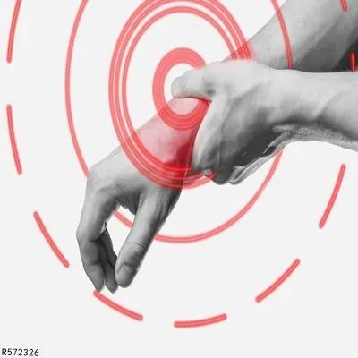 腱鞘囊肿是怎么形成的 腱鞘囊肿形成与三个原因有关