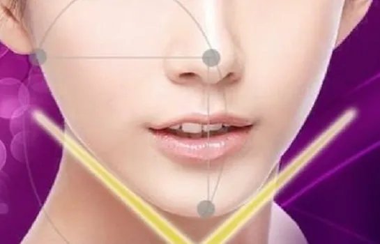 削骨瘦脸手术多少钱