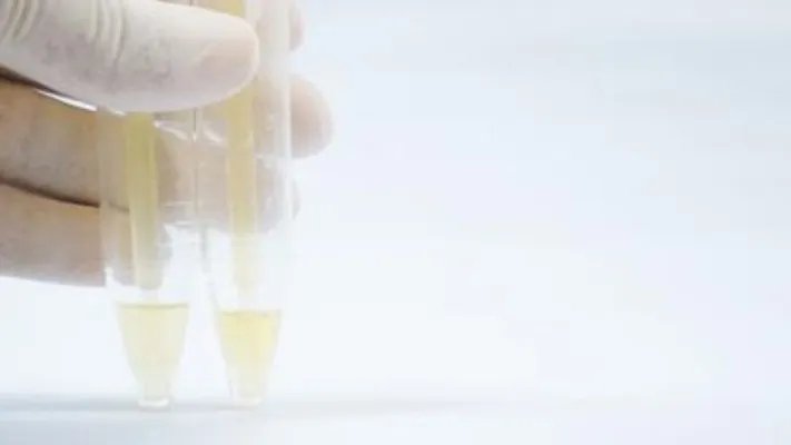 尿素高是什么原因引起的