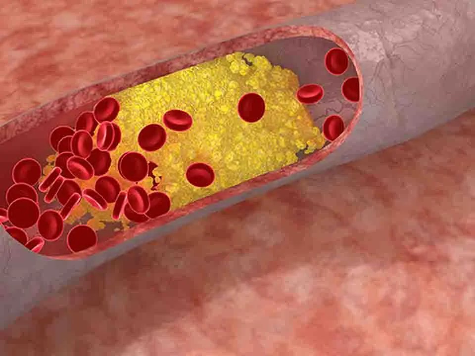 再生障碍性贫血能治好吗