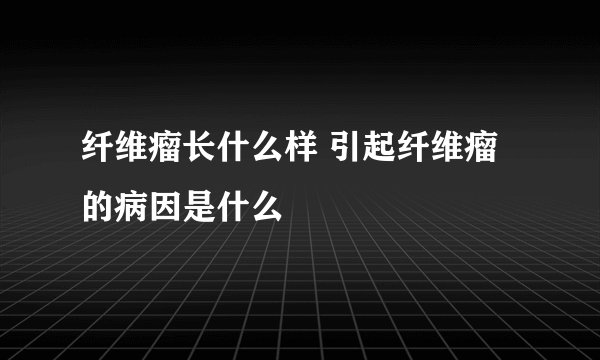 纤维瘤长什么样 引起纤维瘤的病因是什么