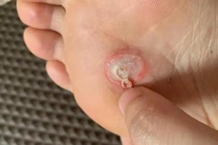 右脚足底疼痛位置图