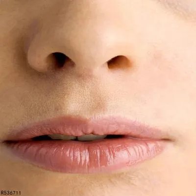 什么是肉芽肿性唇炎 肉芽肿性唇炎的症状细说