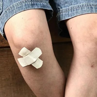 膝盖有什么症状