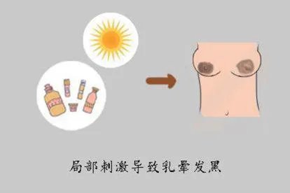 乳晕发黑图片