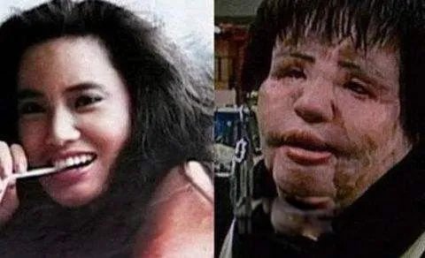 韩苗可为什么要注射食用油 韩苗可原来的样子和现状对比照