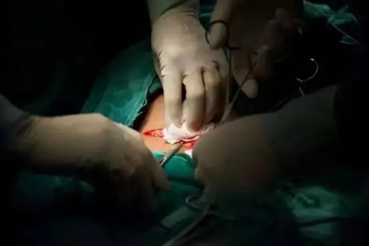 剖腹产7层全过程图片