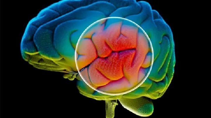 脑癌病人营养品有哪些呢