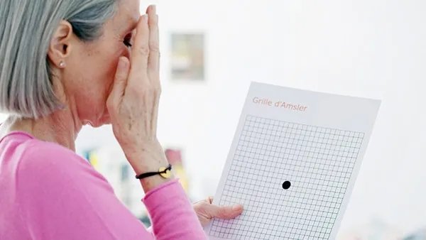 美瞳线没有危害