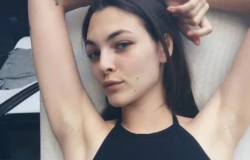 做光子嫩肤多少钱一次