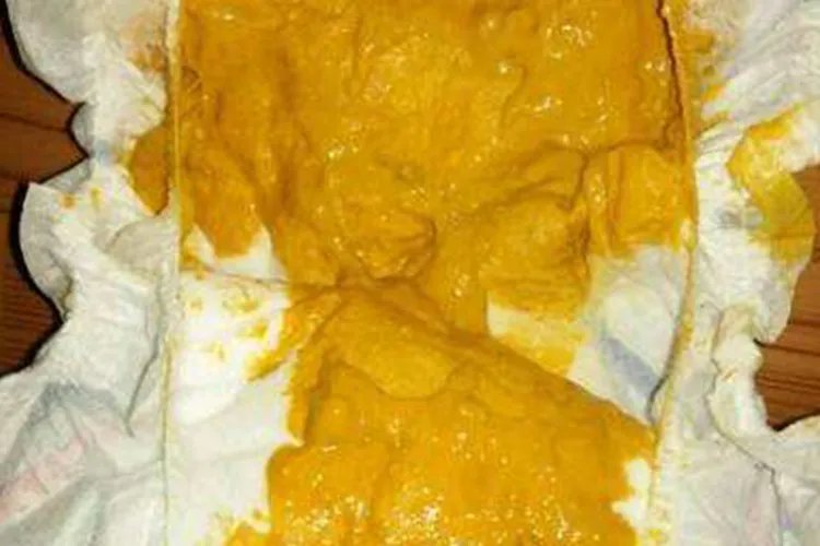 宝宝大便图片大全