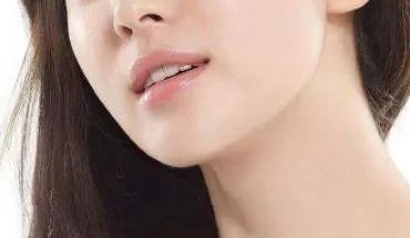 可以用大蒜去斑吗