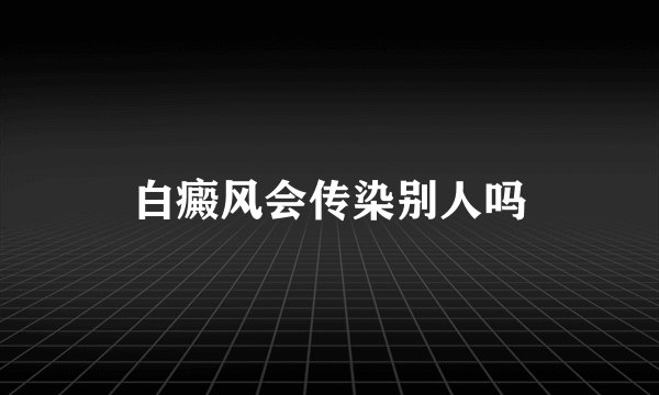 白癜风会传染别人吗