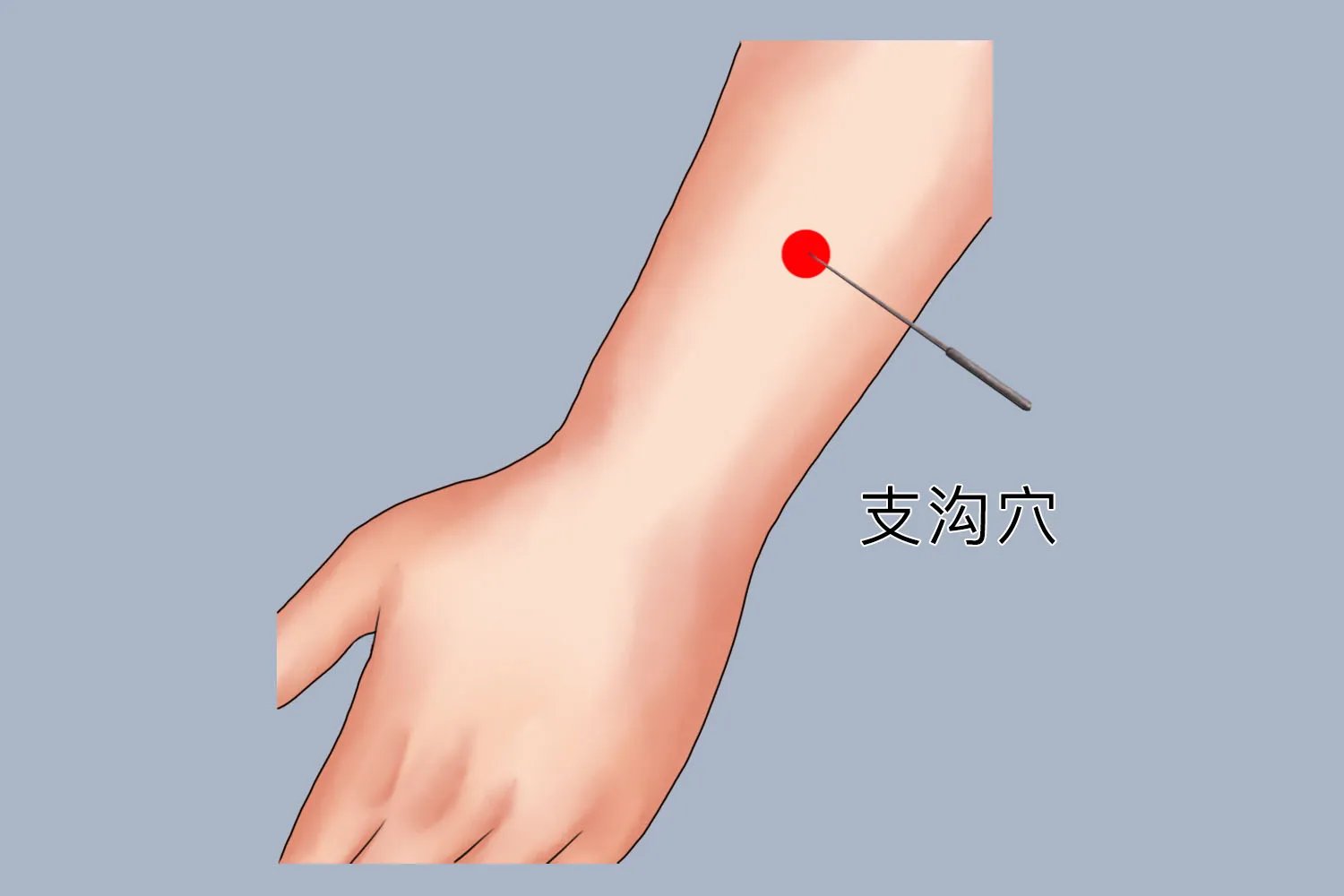 手臂针灸图片