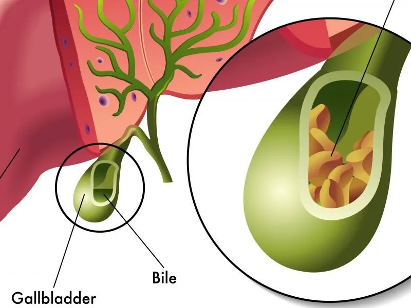 总胆汁酸是什么