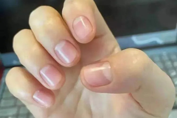 正常的指甲应该是怎样的图片