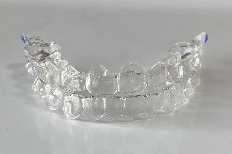 牙套分几种类型图片，有什么区别