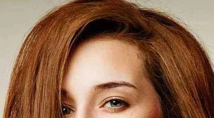 毛发种植后要注意什么