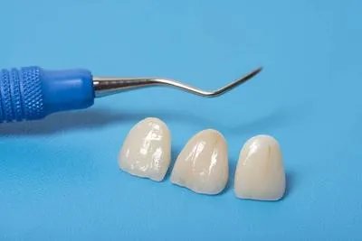 冠周炎吃什么药最有效 冠周炎患者可以吃四种药