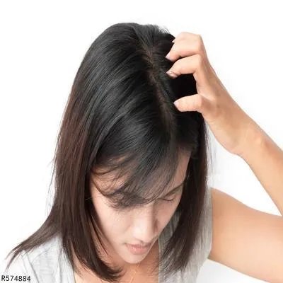 头皮屑多怎么清洗