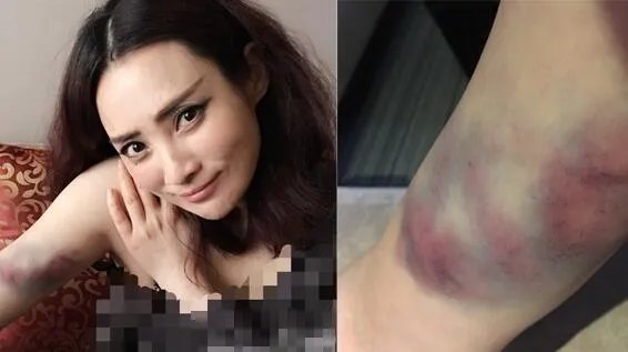 蒋勤勤拍戏受伤照片曝出   网友感叹:女神真的老了