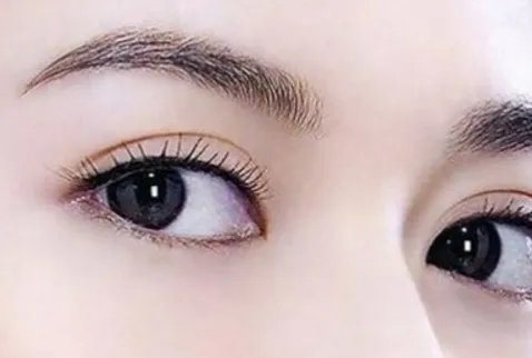 眼部整形手术好处