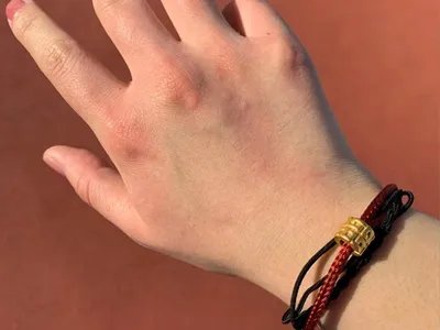 运动诱导性荨麻疹症状图片