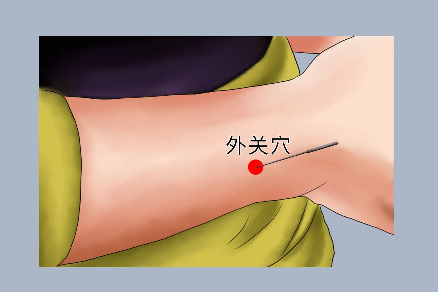 手臂针灸图片