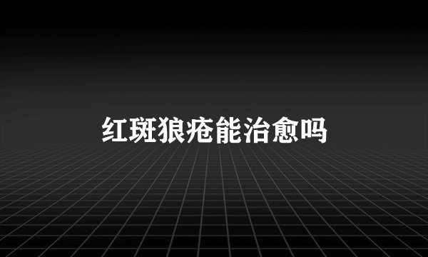 红斑狼疮能治愈吗