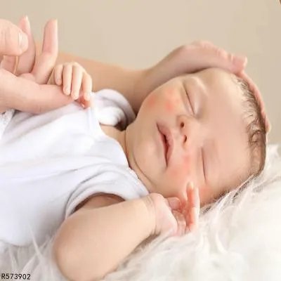 宝宝脸上起红点怎么回事