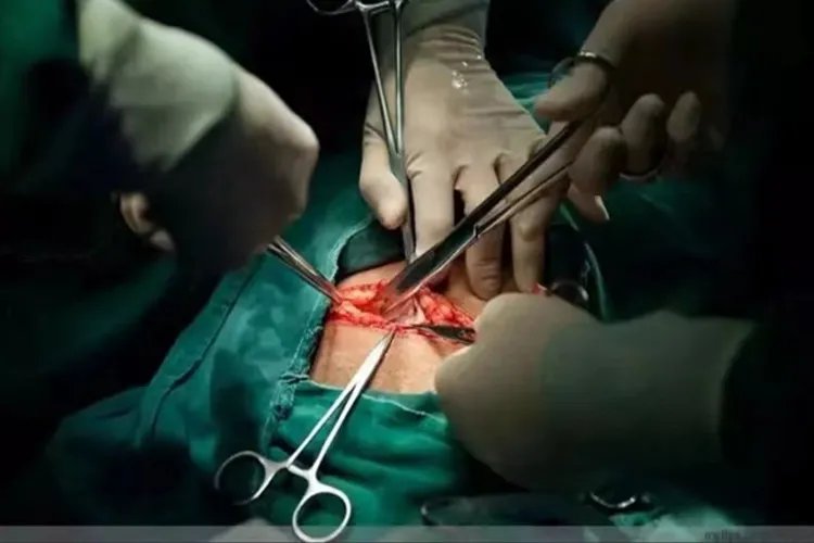 剖腹产7层全过程图片