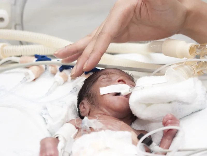 新生儿复苏是什么意思