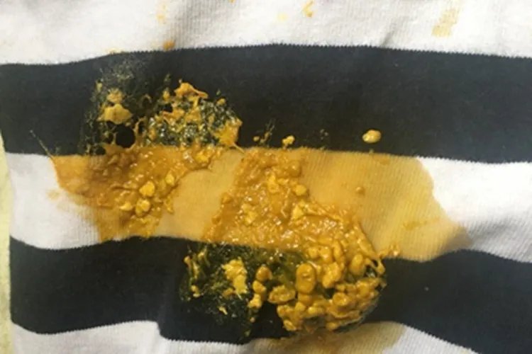 宝宝大便图片大全