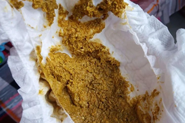 宝宝大便图片大全