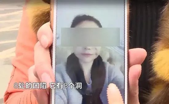 女子脸部整容整出八个坑整形机构人员怎么说？