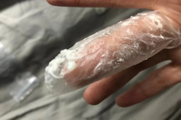 白带正常和不正常的图片