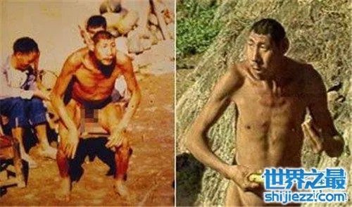 猴娃之谜的真相是什么 科学家表示竟然是这种病 