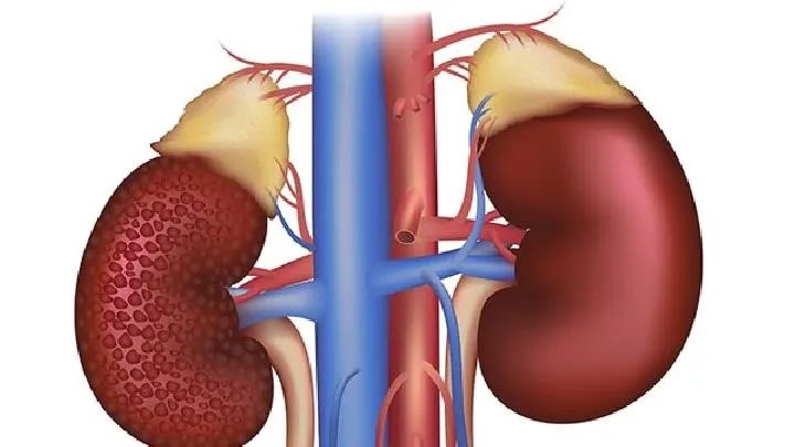 高血压肾病的诊断依据
