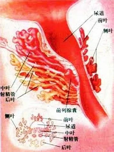 慢性前列腺症状有哪些?