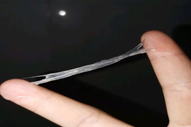 白带正常和不正常的图片