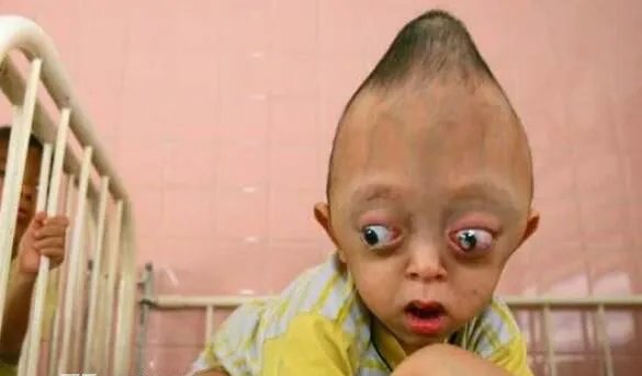 福岛核泄漏后变异女人是真的吗 乍一看十分骇人