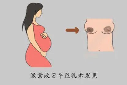 乳晕发黑图片