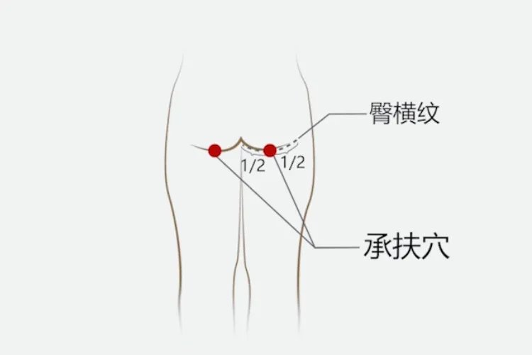 腿部拔罐12个位置示意图